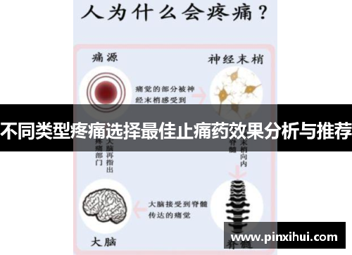 不同类型疼痛选择最佳止痛药效果分析与推荐