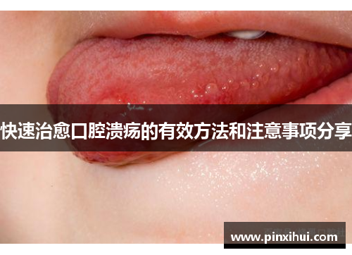 快速治愈口腔溃疡的有效方法和注意事项分享
